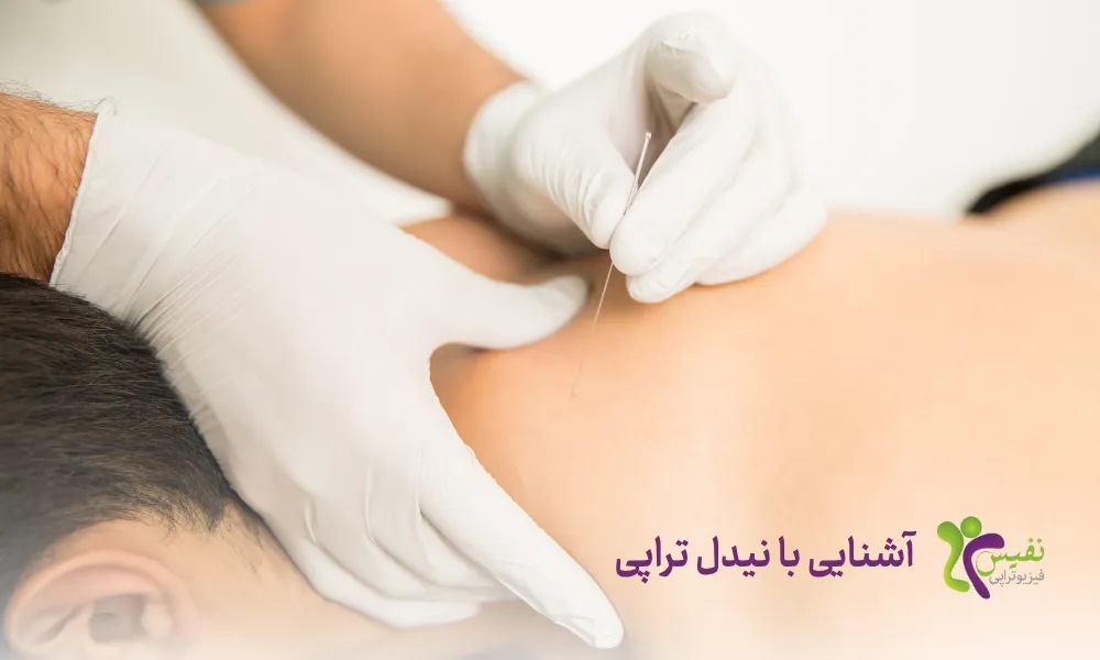 آشنایی با نیدل تراپی - درای نیدلیگ چیست