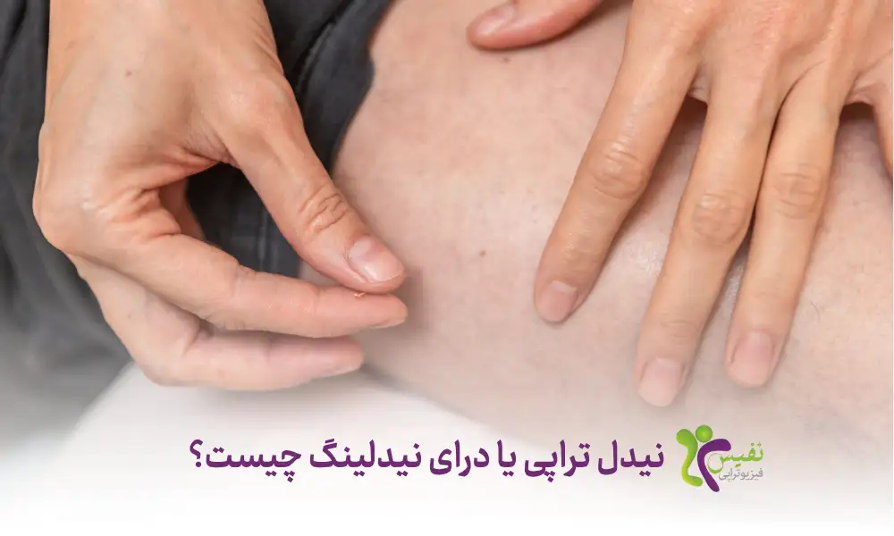 نیدل تراپی چیست - درای نیدلینگ یا سوزن خشک چیست